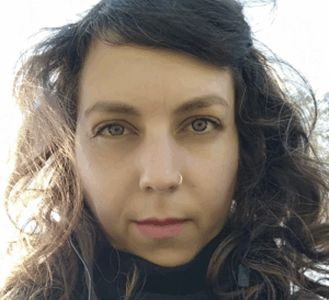 שר ניב קוקסינלית שתבעה למימון ניתוח נישוי פנים