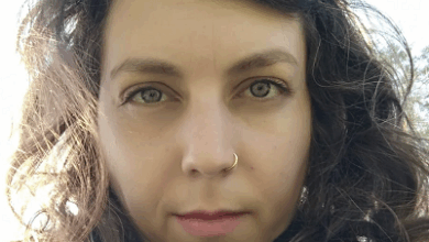 שר ניב קוקסינלית שתבעה למימון ניתוח נישוי פנים