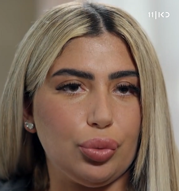 אורטל מרציאנו תובעת 2.5 מיליון של מבית חולים רמבם